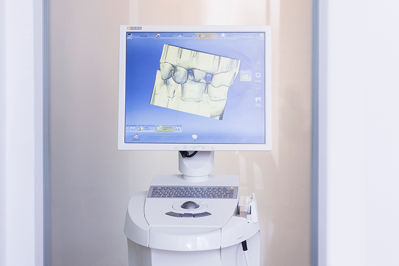 Cerec